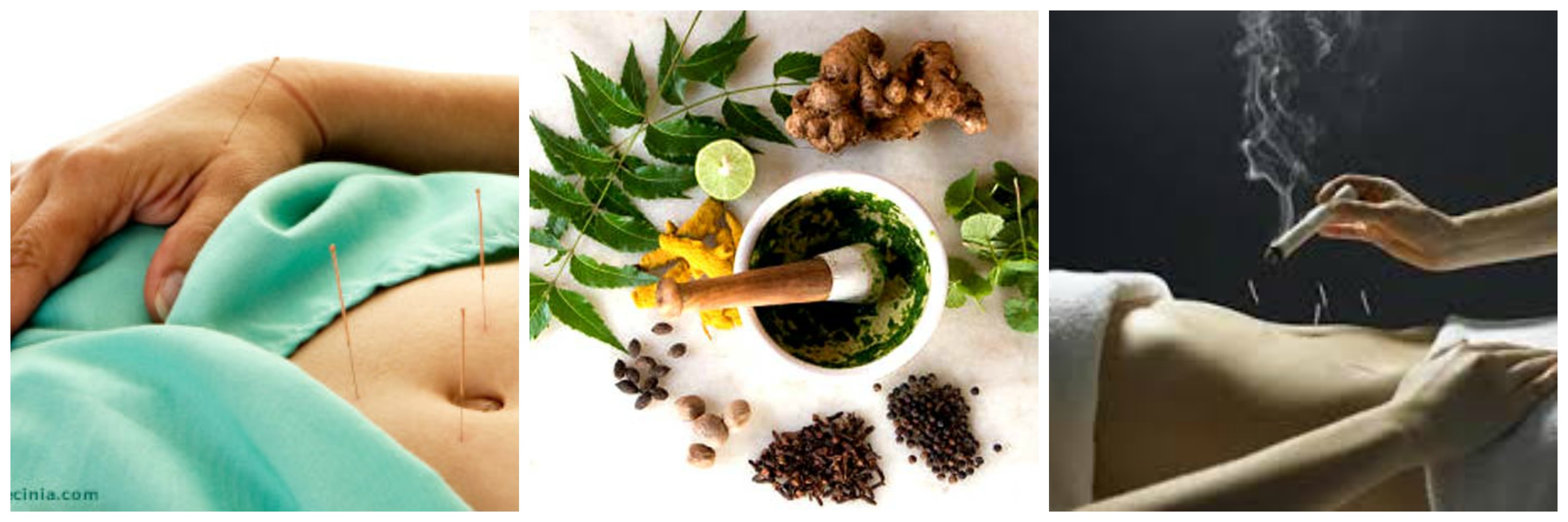 47+ Acupuncture for fertility success stories image ideas