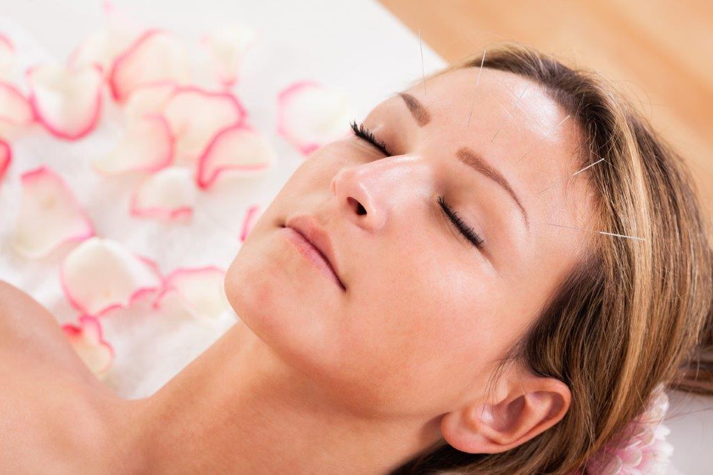 Why You Should Ditch Your Dermatologist For Acupuncture - Eastern Therapies