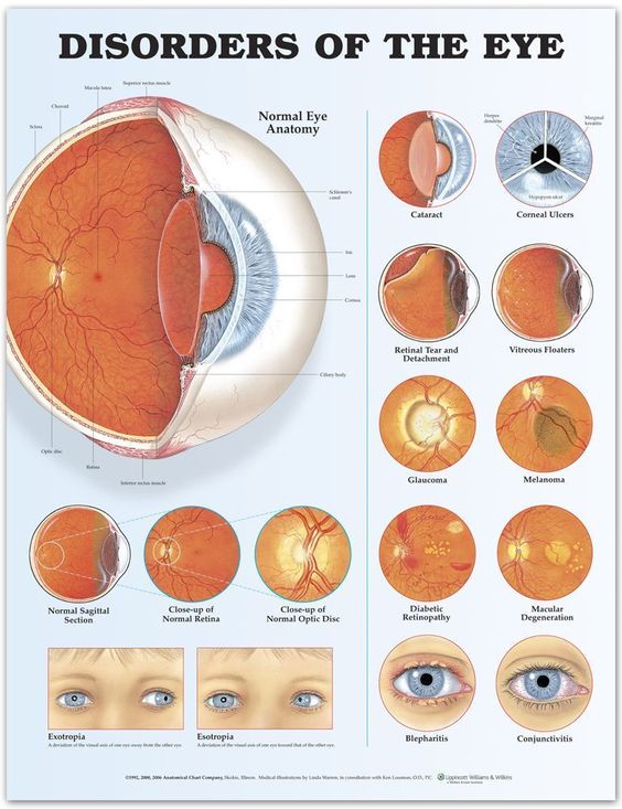 vision 5