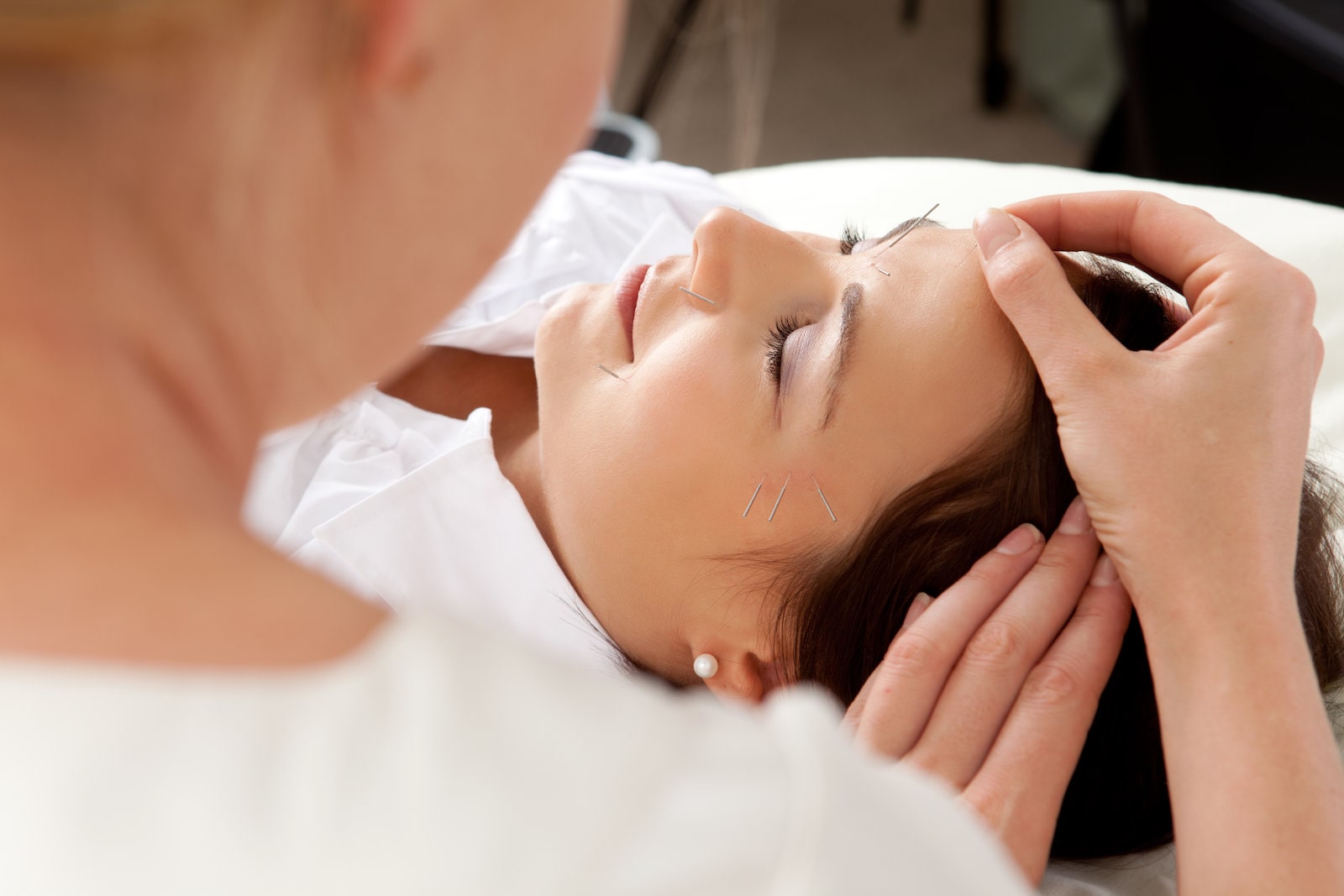 woman doing Cosmetic Acupuncture